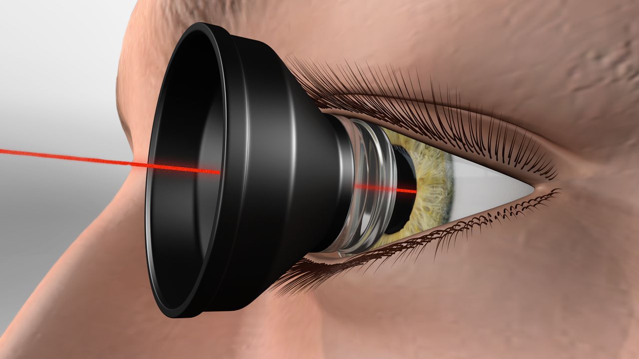 Advanced Private Laser Therapies for Retinal Conditions